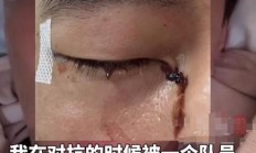开云平台-包含篮球名将受伤重创，全球球迷为之惋惜的词条